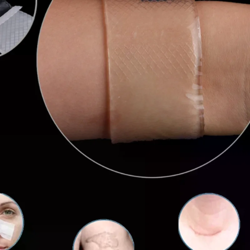 Scar Therapy Remove Trauma Burn Silicon Patch Reusable Acne Gel Skin Repair New