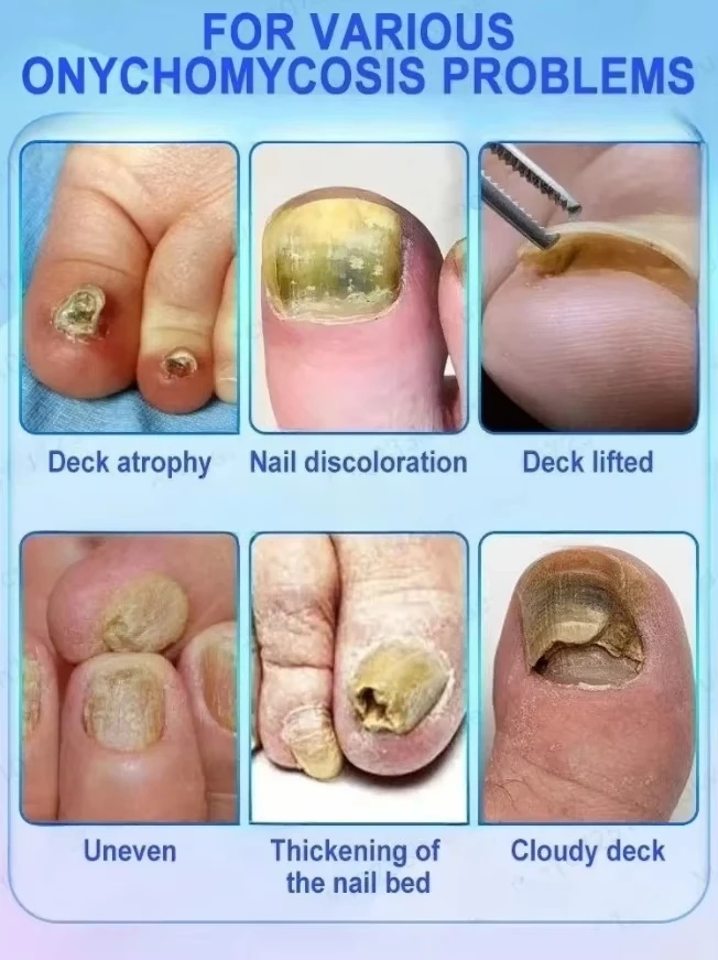 Thumbnail 4 - #33 Foot Files Comparison Guide