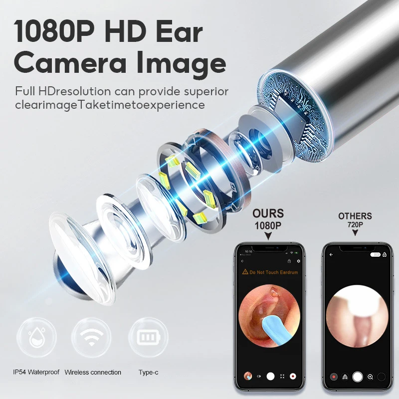 Smart Visual Ear Cleaner HD Ear Sticks Otoscope USB C Charging Endoscope Wax Removal Tool Earpick MIni Camera Health Care Set