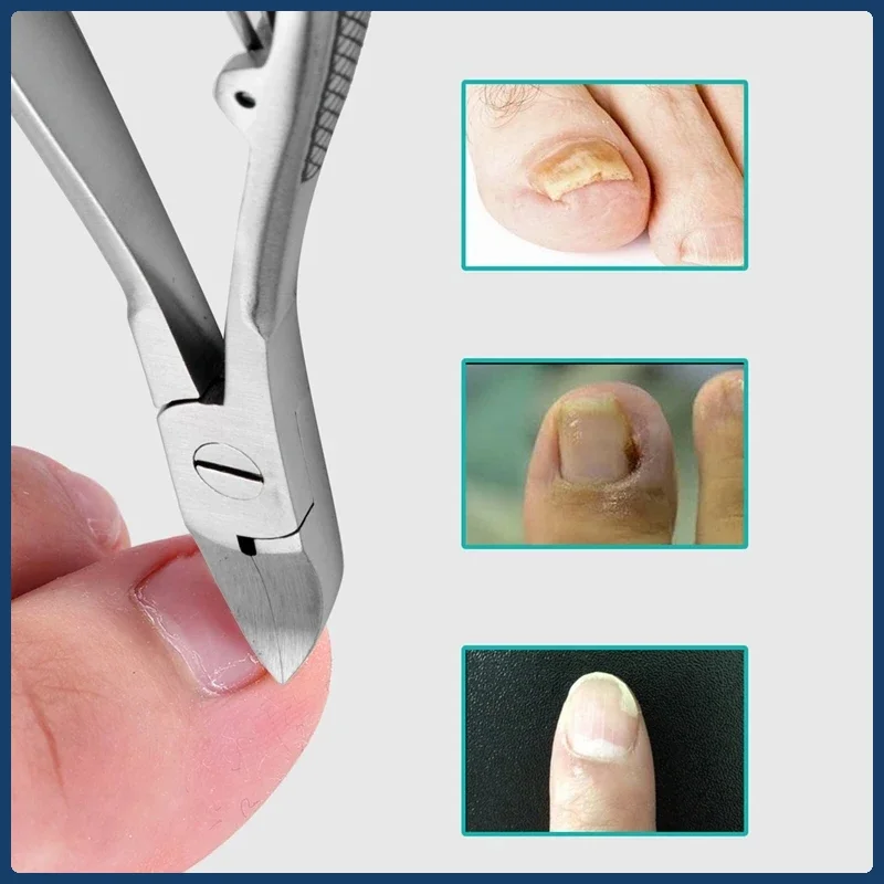 Feet Toe Nail Clippers Trimmer Cutters Paronychia Nippers Podiatry Stainless Foot Care Tools