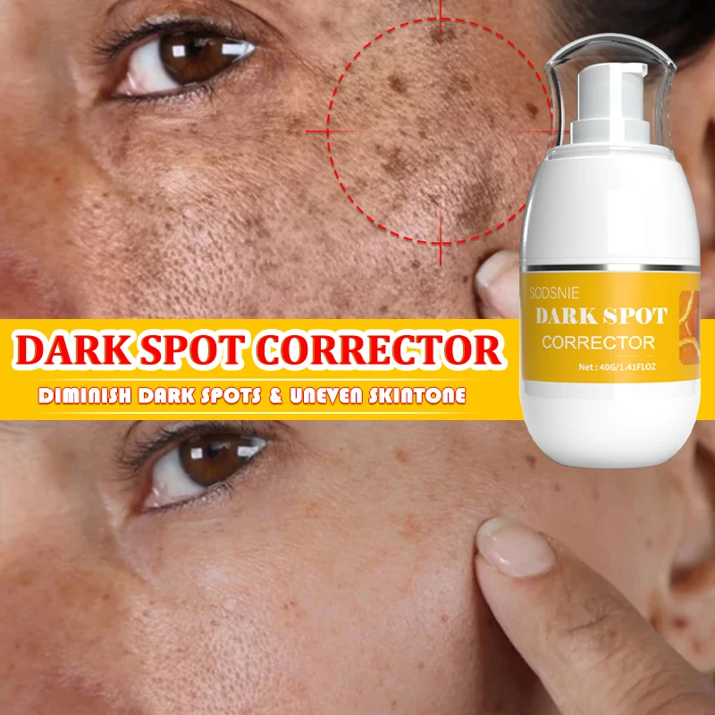 Dark Spot Corrector Intense Freckle Cream Whitening Fade Removal Melasma Sun Spot Moisturizing Brightening Skincare Beauty 40g