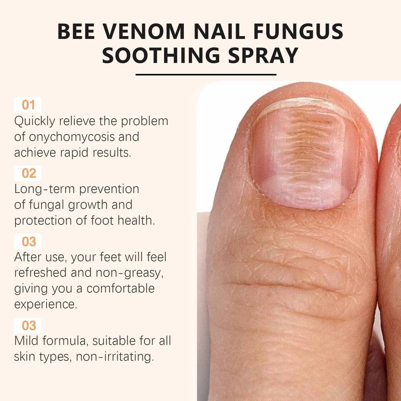 Venmo Nail Fungus Spray lenitivo trattamento di scolorimento delle unghie ad azione rapida per Peeling fragile che rompe le unghie sottili