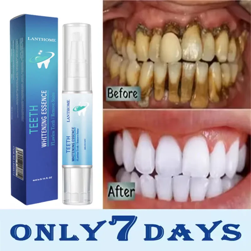 V34 Teeth Whtening Toothpaste Pen Remove Plaque Stains Cleaning Oral Hygiene Bleaching Dental Tools Fresh Breath Tooth Care