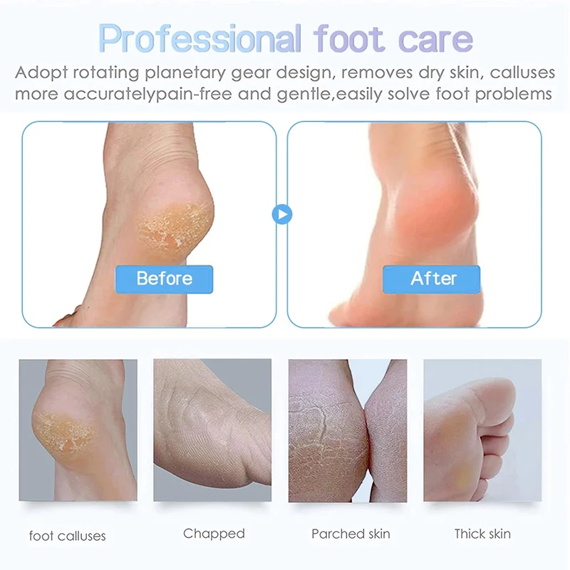Strumenti per la cura del piede Macchina elettronica per la rimozione del callo del piede Rimozione del callo Rimozione della pelle morta Smerigliatrice elettrica per piedi