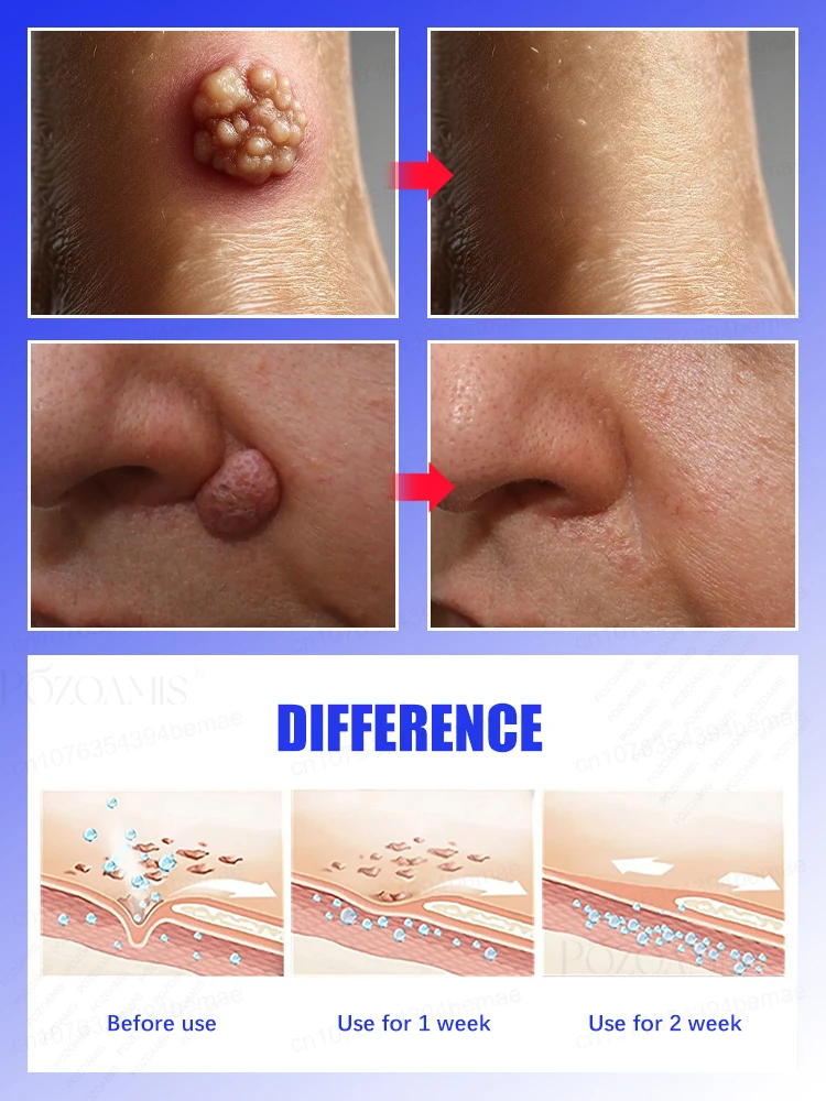 Fʟᴀᴡʟᴇss sᴋɪɴ