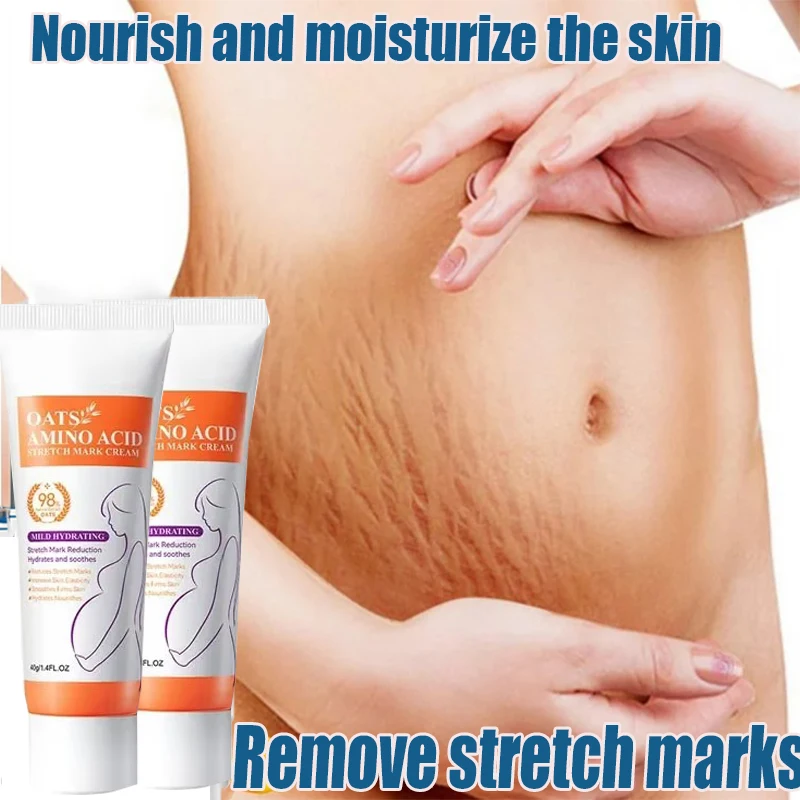 

Stretch Marks Permanent Removal Cream Eliminate Body Belly Stretch Marks Swelling Marks Remove Skin Cracks Repair Firming Care