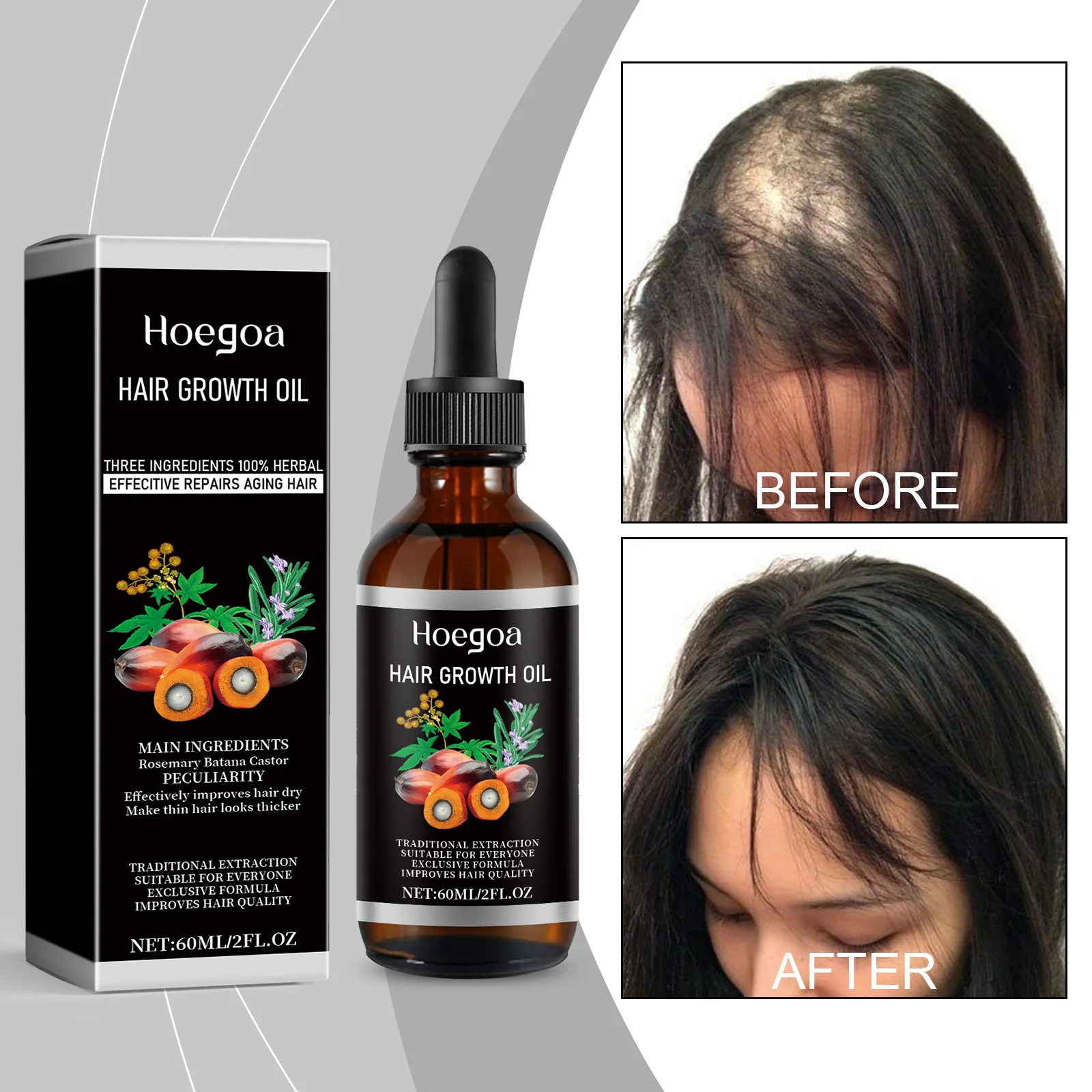 

Palm Oil Hair Natural Hair Growth Dry Damaged Keratin Repairing Baldness Thinning Scalp Treatment Hair Loss Essential Oil 60ml