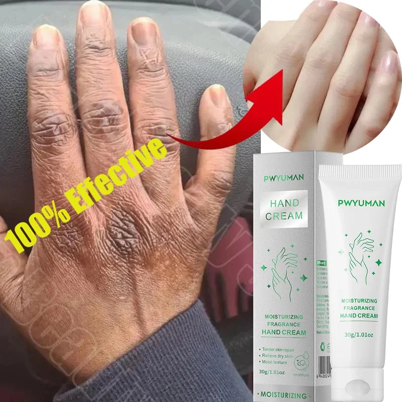 

Dark Knuckles Fast Whitening Hand Cream Anti-crack Repair Products Pigmentation Correctors For Black Skin Smooth Hand Care