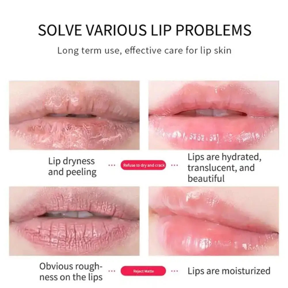 2025 الشتاء الكولاجين الشفاه التصحيح ترطيب وتحلية خط الشفاه اختراق سول الشفاه مرآة الرعاية لصقة هلامية #2