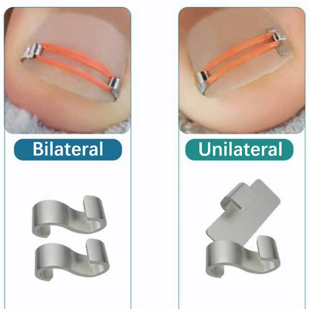 Corrector de uñas encarnadas, ortopédico, cómodo, conductor, Forma Natural