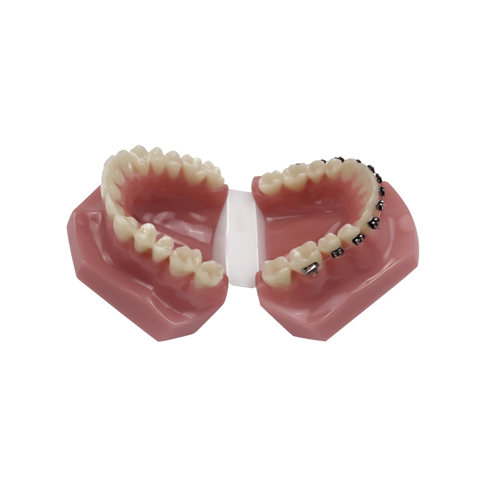 With Invisible Bracket Transparent Retainer Dental Tooth Model Orthodontic Demonstration for Patient Teaching Study Dentistry