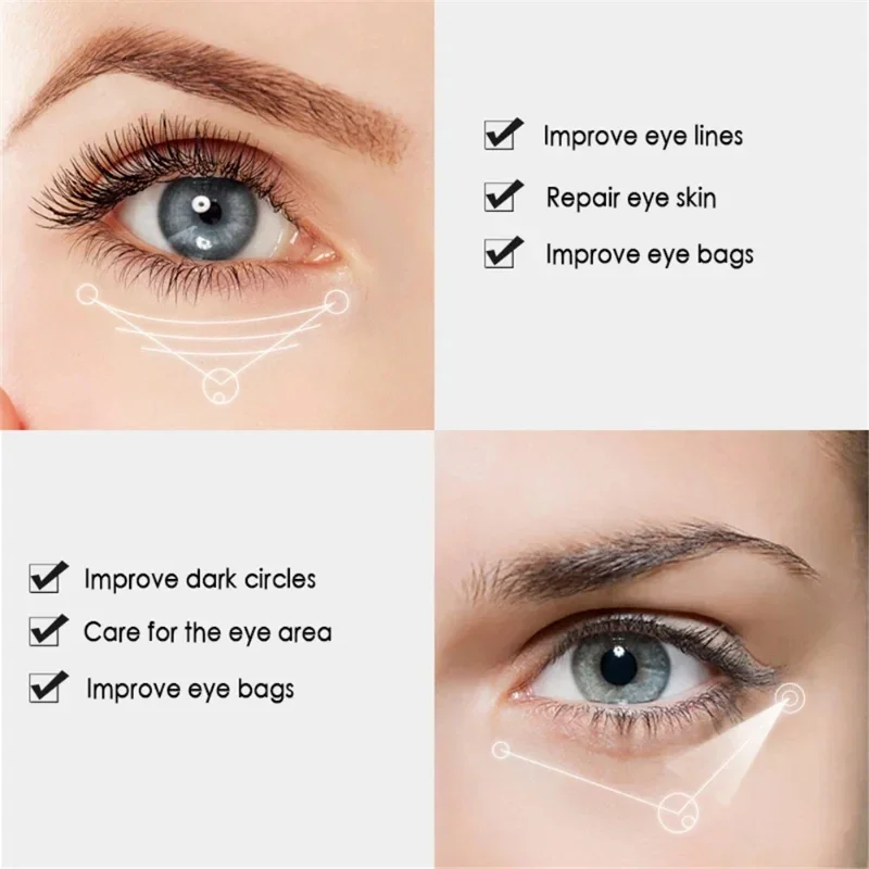 Nicotinamide Eyes Cream Fading Dark Circles Eye Bags Eye Hyaluronic Acid Moisturizing Serum Against Puffiness Eye Care Cosmetics