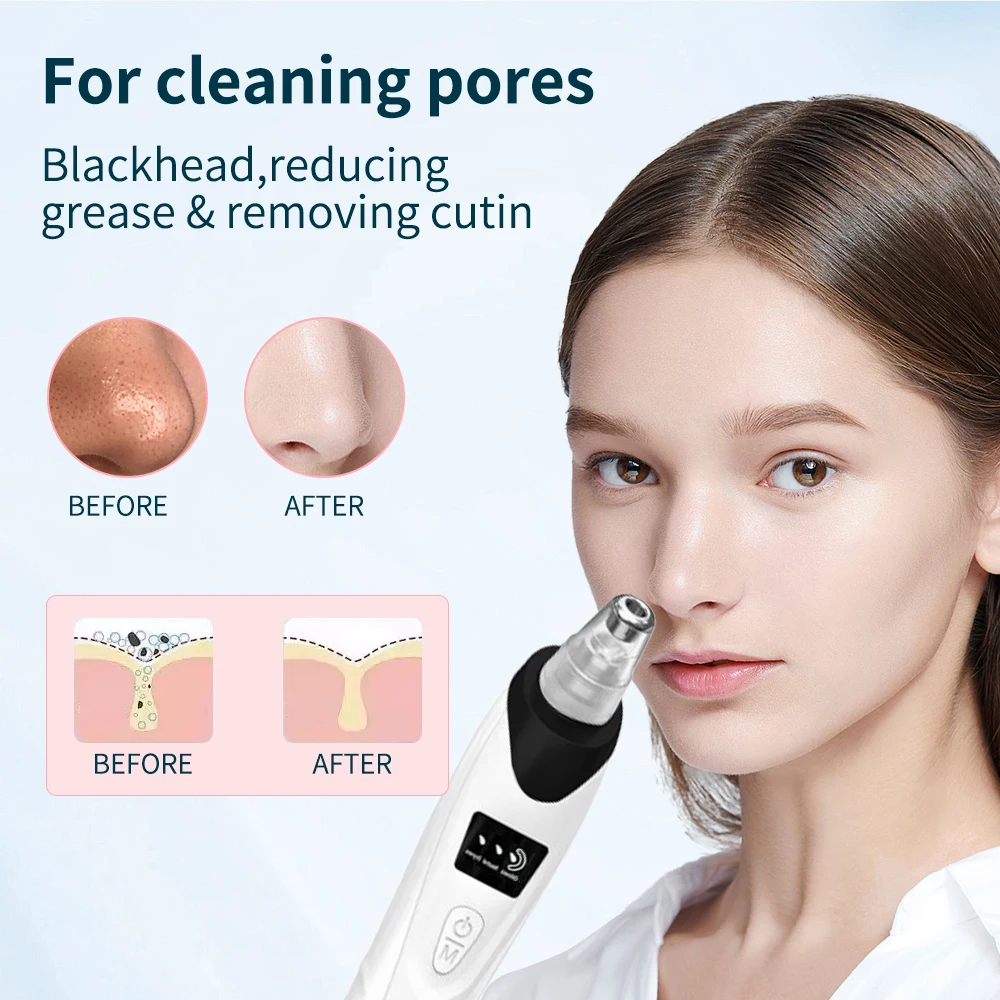 مجموعة هدايا عيد الميلاد الجديدة لعام 2025، جهاز تنظيف الوجه ذو 3 شفط - منظف المسام المفرغ لإزالة الرؤوس السوداء والجلد الميت