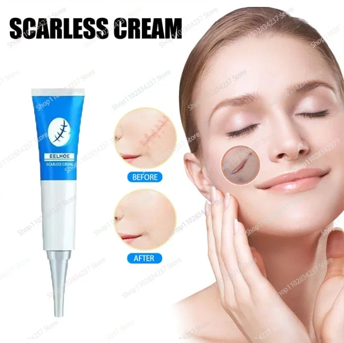 Fast Scar Repair Maternity Skin Repair Remove Pregnancy Surgical Scars Body Skin Care Cream