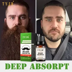 Men Beard Growth oil 10ml Moustache Treatment Liquid Beard Increase liquid Hair growth fluid Hair Care Essence Improves Hair