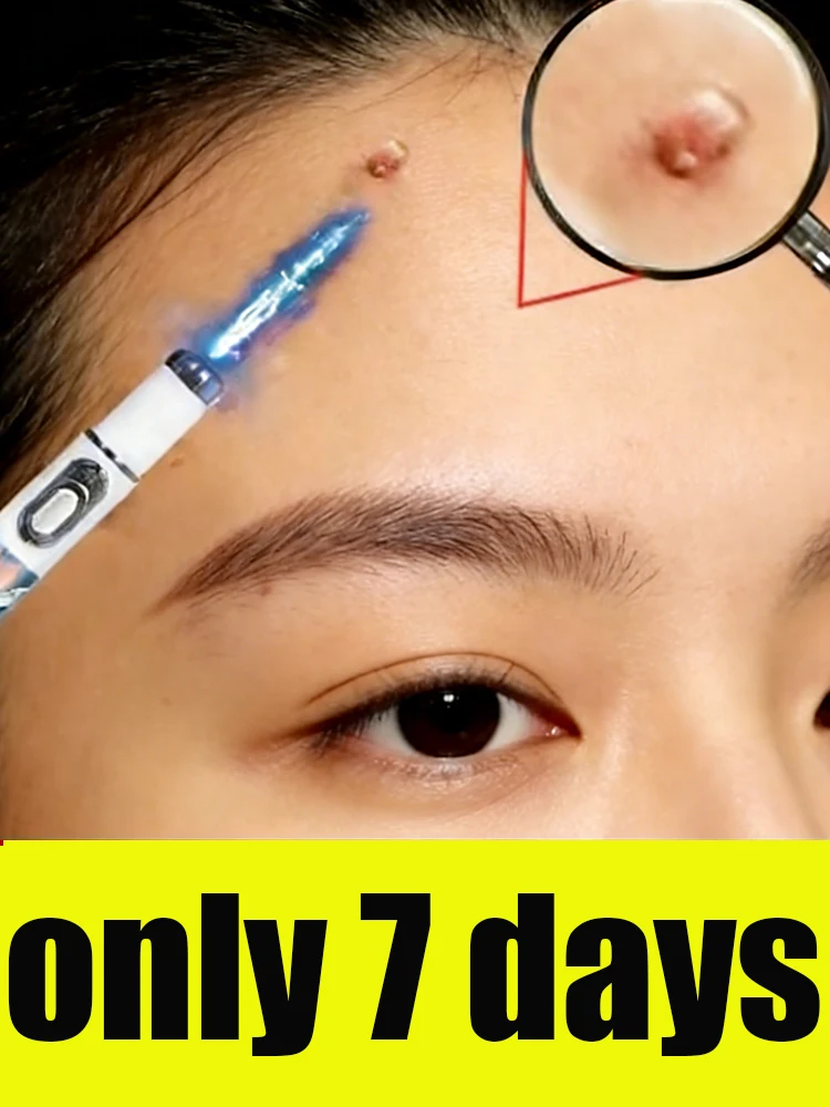 Professional And Practical Structure Mini Beauty Laser Pen Sophisticated Design And Best Selling Z9 X623