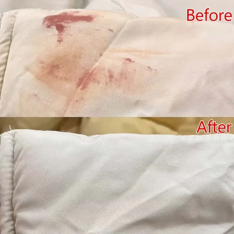 1-10 متر أسفل سترة مكافحة الأوساخ ملصق غير مرئية غير لاصق المتاح طوق بطانة سترة الأصفاد شفافة مكافحة وصمة عار قطعة أثرية