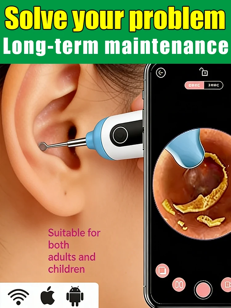 

Популярный беспроводной очиститель ушей с камерой, перезаряжаемый, HD-камера для осмотра уха с набором ложек для чистки слухового прохода