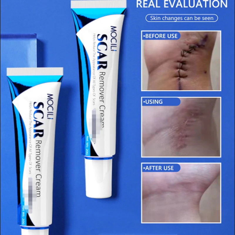 Herbal Scar Removal Cream Treatment Burn Surgical Scar Stretch Marks Acne Spots Repair Pigmentation Body Smooth Beauty Skin Care