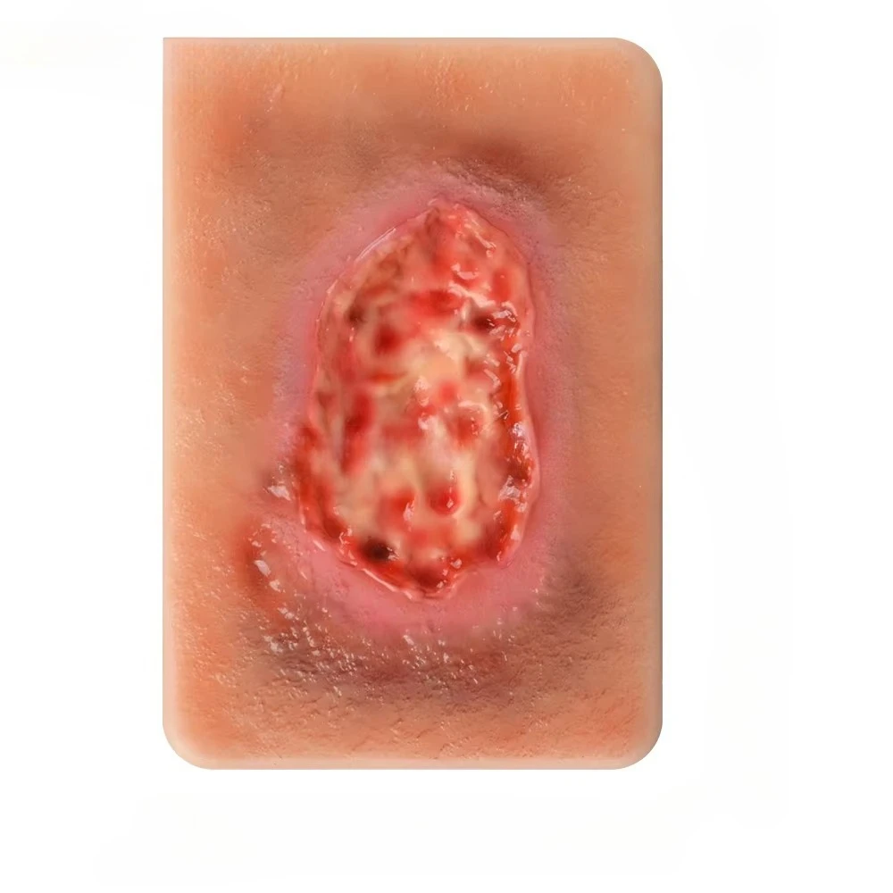 

3 Types of Necrotic Tissue Model Pocket Wound Card for Wound Care Education