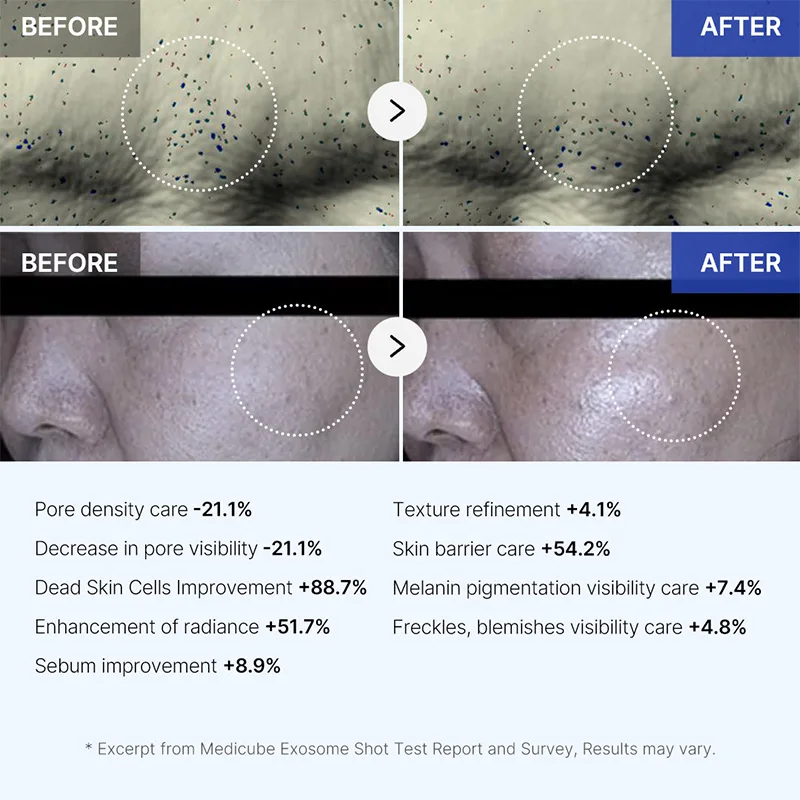 Siero Booster per la pelle coreano, detergente per il viso rimuovi la crema restringente per i pori dell\'acne, lozione per la cura idratante