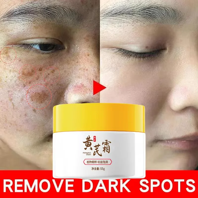 Astragalus Whitening Freckles Cream Face Dark Spots Remover Repair Products Removal Melasma Melanin Moisturiz Brighten Skin Care