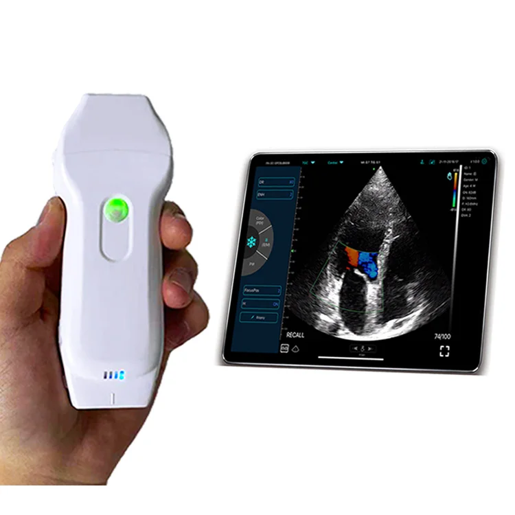 Lineaire Echografie Sonde Medische Beeldvormingsapparatuur Echografie Cardiale Sonde Draadloze Handheld Konted C10xl Handheld Oppervlakkig