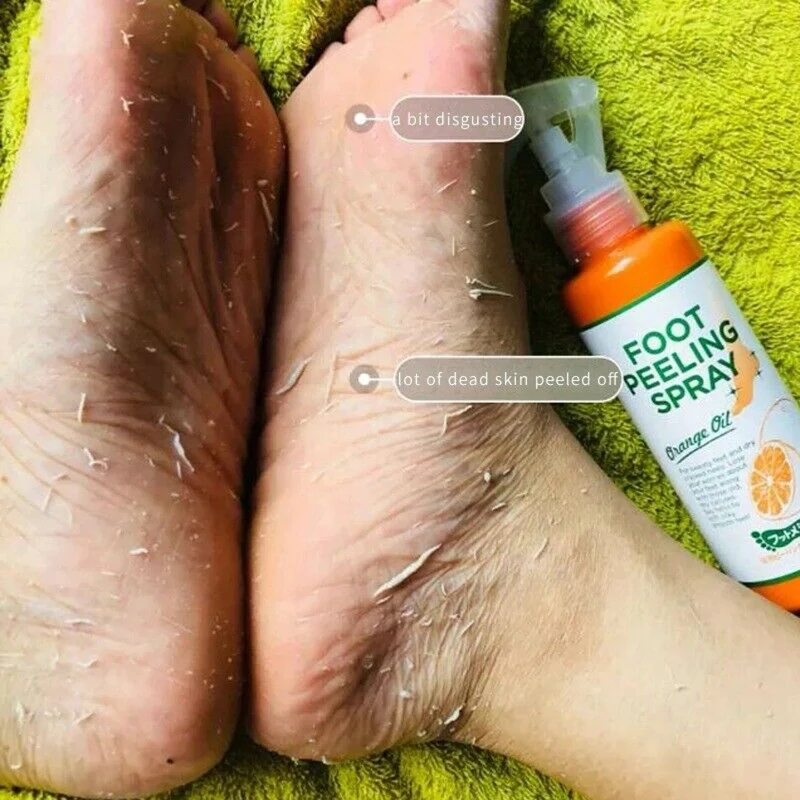 Image of 100ml Fußpflege-Spray Entfernt Abgestorbene Haut Fußpeeling Weichmacher Pflegt Sanft die Fußhaut Befeuchtet Hydratisiert Verbessert Trockenheit 2026