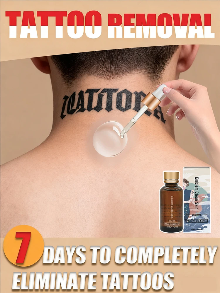 

Tattoo Removal Solution: Say Goodbye to Your Tattoo in 7 Days