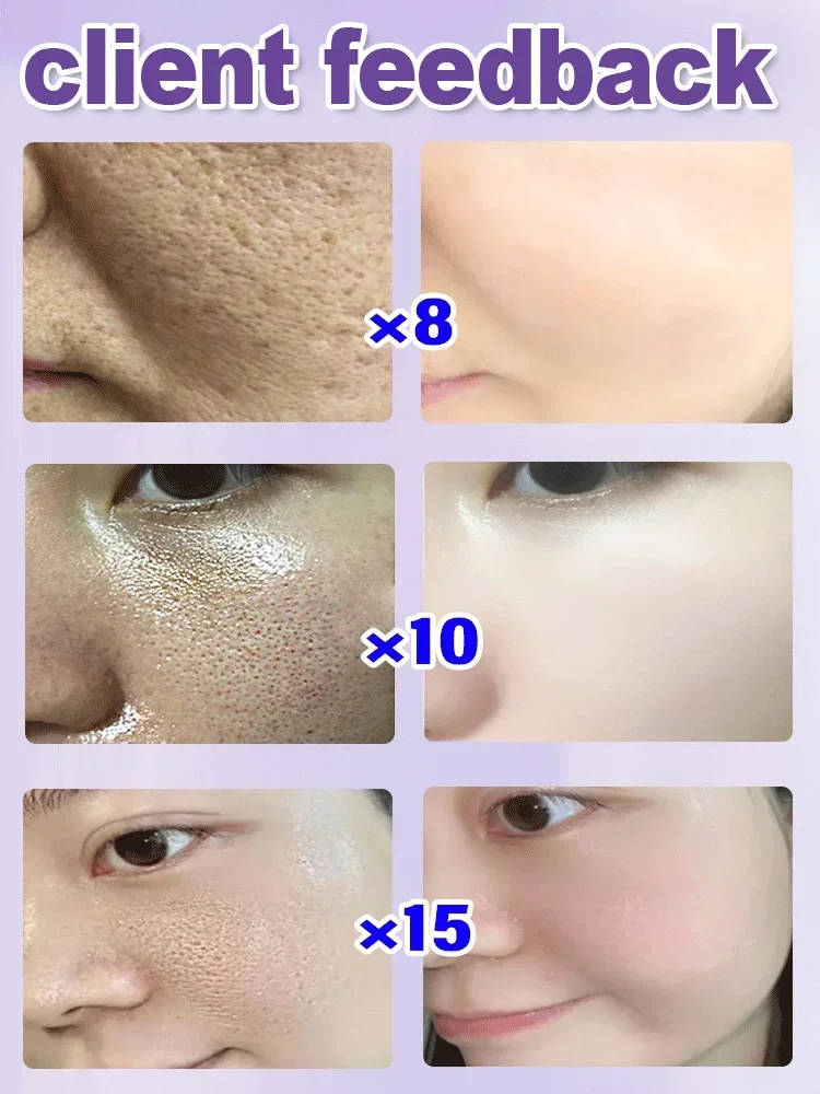 Pore Shrinking Face Serum  Pores Blackheads Whitening Moisturizing Smooth Skin Care Products