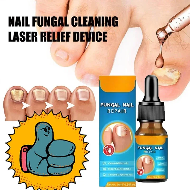 Foot Repair Essence Fungal Treatment Serum Fungal Nail Care Massage Essential Oil