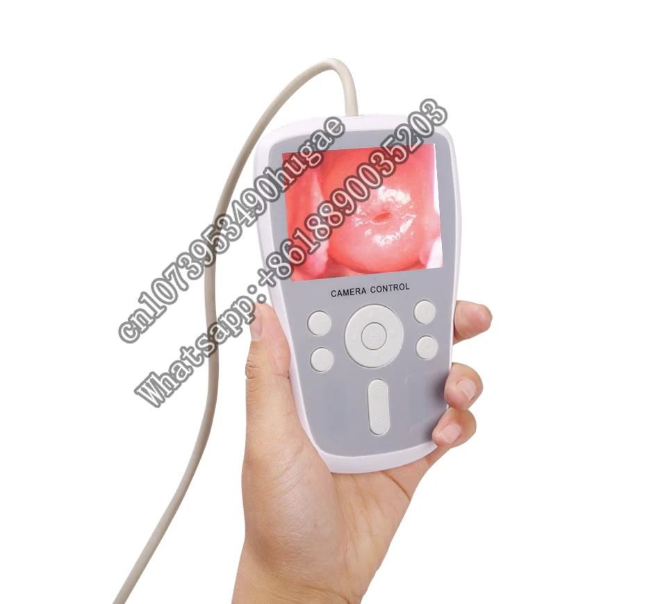 Portable Digital Vagina Video Colposcope For Gynecology