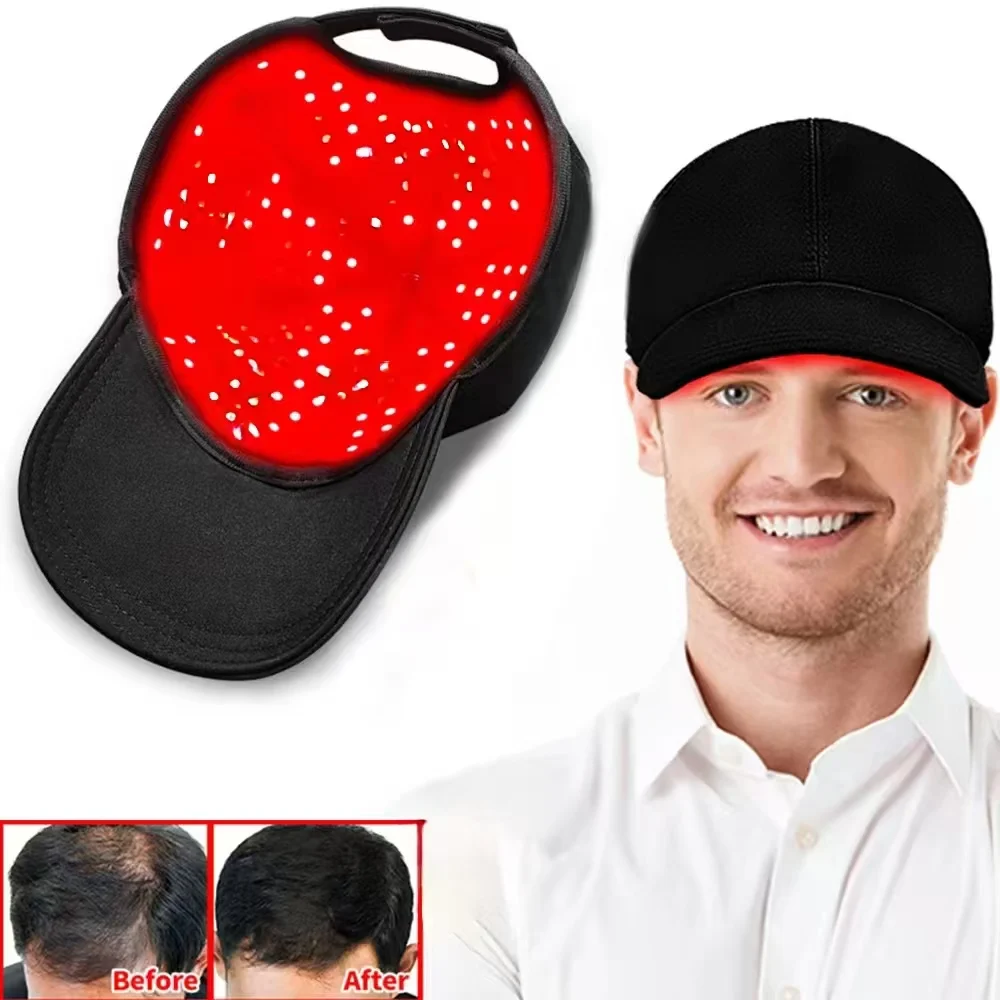 LLLT Low Level Laser Cap 208 Diodes Professional Hair Growth System Hair Restoration Men Women