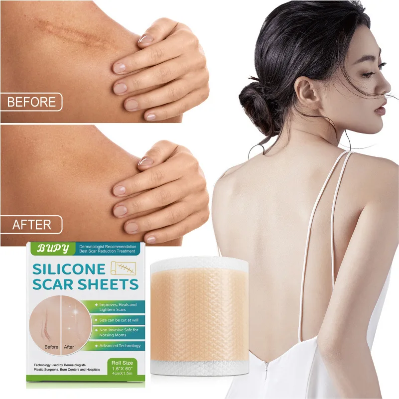 Hot 300CM Silicone Scar Sheets Skin Repair Patch Removal Self-Adhesive Stretch Mark Tape Therapy Patch Burn Acne Scar Skin Care