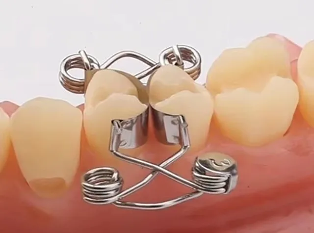 مجموعات نظام مصفوفة الأسنان المقطعية الأوتوماتيكية للأطفال ، ملقط المصفوفات ، أدوات طبيب الأسنان ، أداة طبيب الأسنان