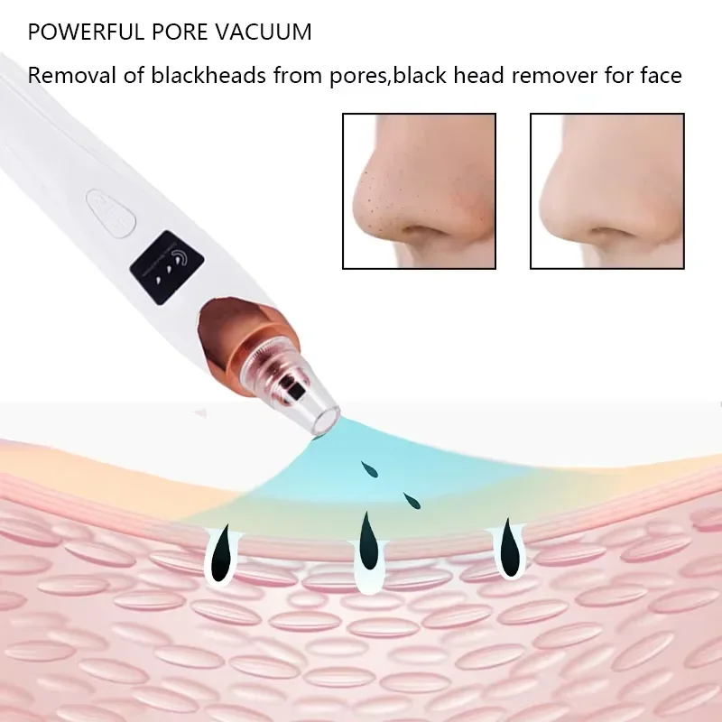 Blackhead Remover Vacuum Suction USB Rechargeable Facial Pore Cleaner Spot Acne Pimple Black Head Extractor Face Clean Skin Care