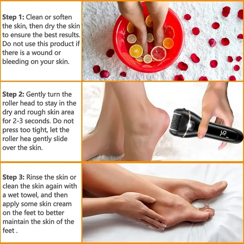Elétrica recarregável arquivo de pé removedor de calos kits máquina carregamento rápido profissional remover pele dura morta ferramentas cuidados com os pés