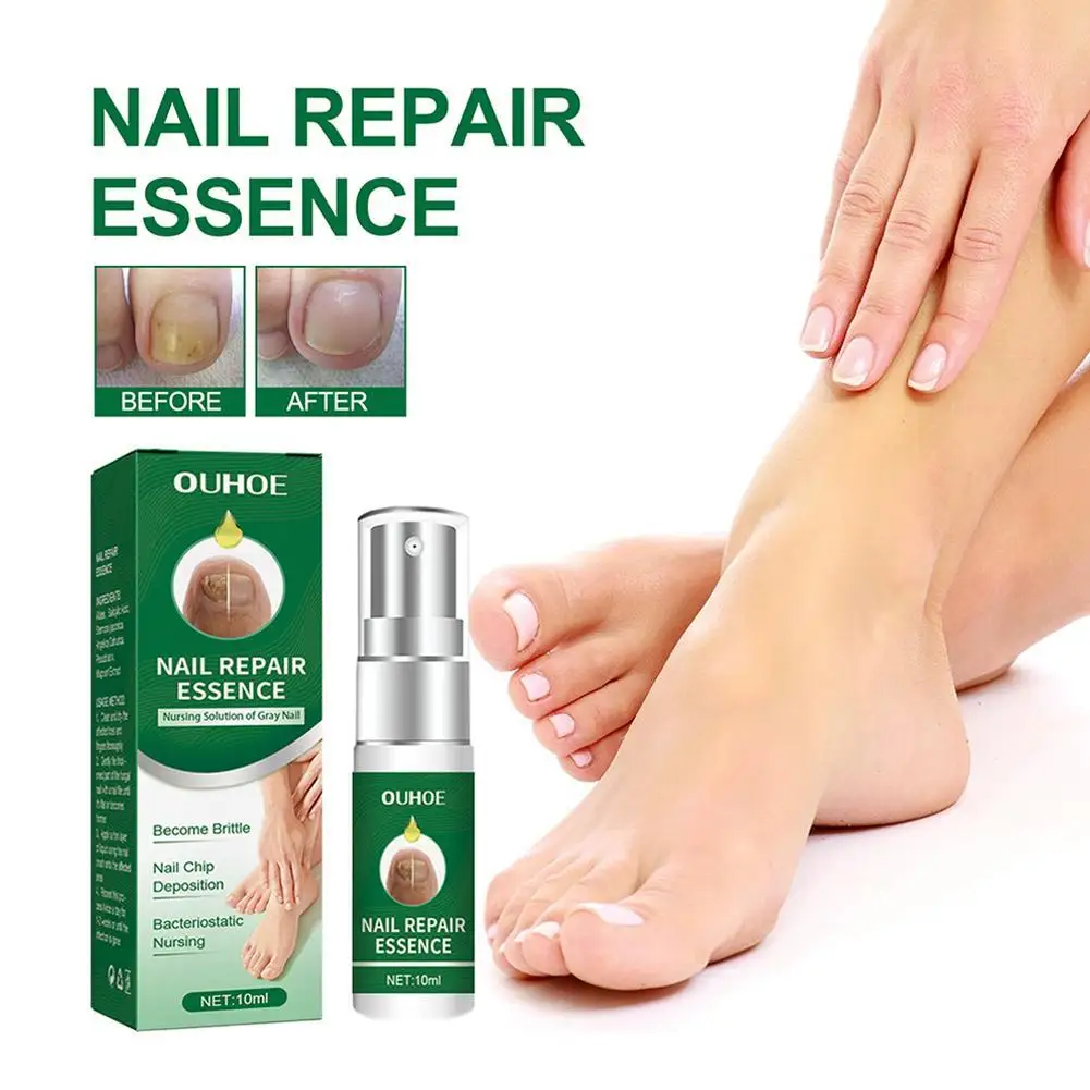 Reparación de uñas multiusos, esencia de reparación de uñas de los pies, protege las uñas de daños, para reparar uñas descoloridas y dañadas, 10ml