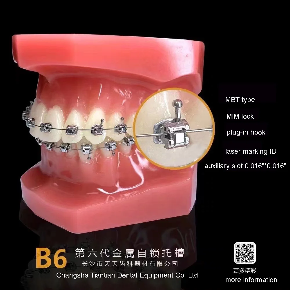 2023 China factory directly sale orthodontic teeth braces bondable self-ligating braces for ortodoncia