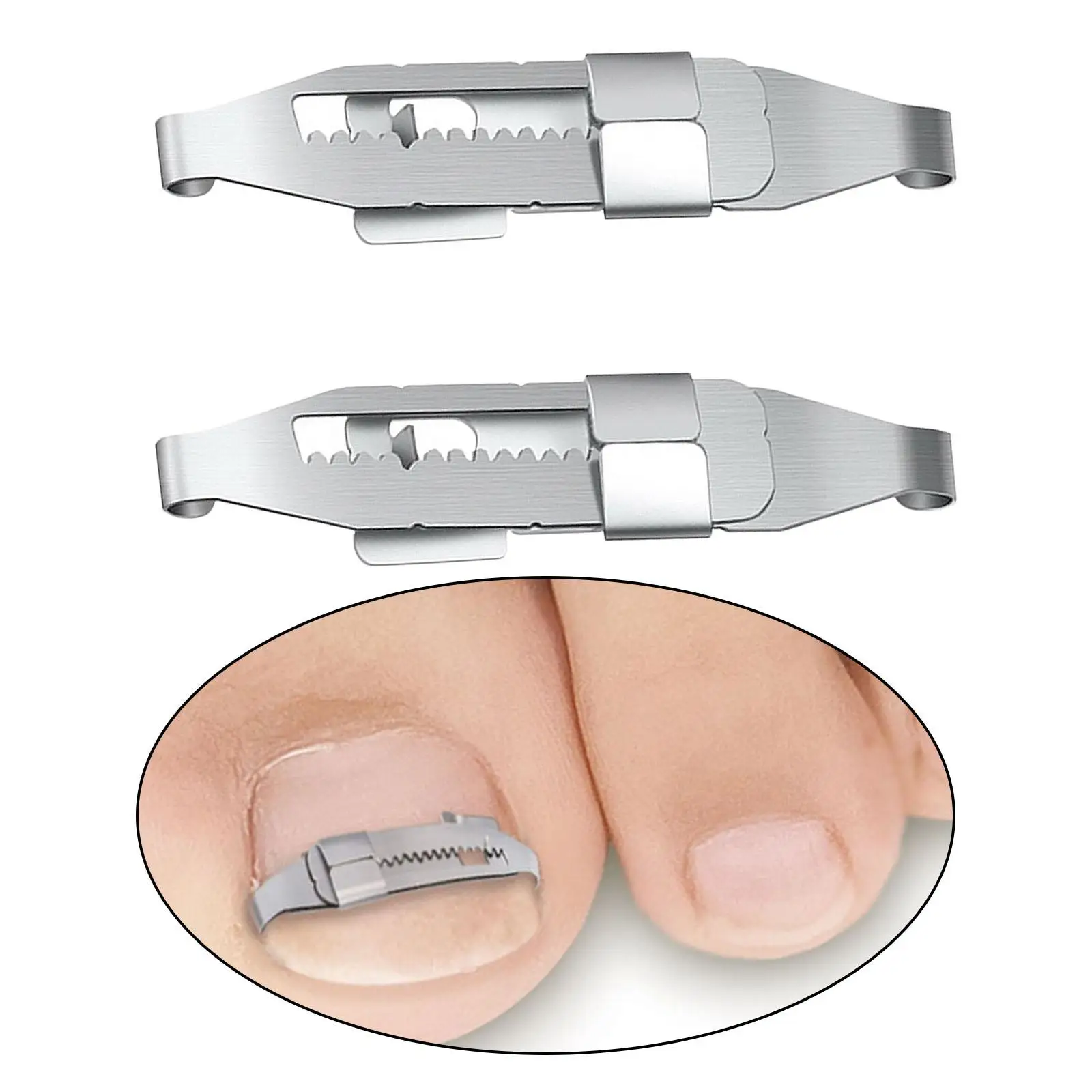 Professional Ingrown Toenail Corrector Tools Embed Toe Nails Treatment
