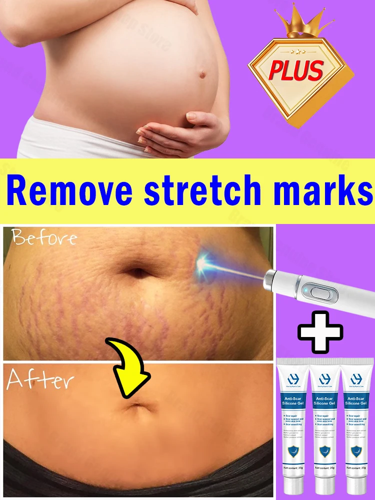 

Postpartum Skin Care,Marks Cream