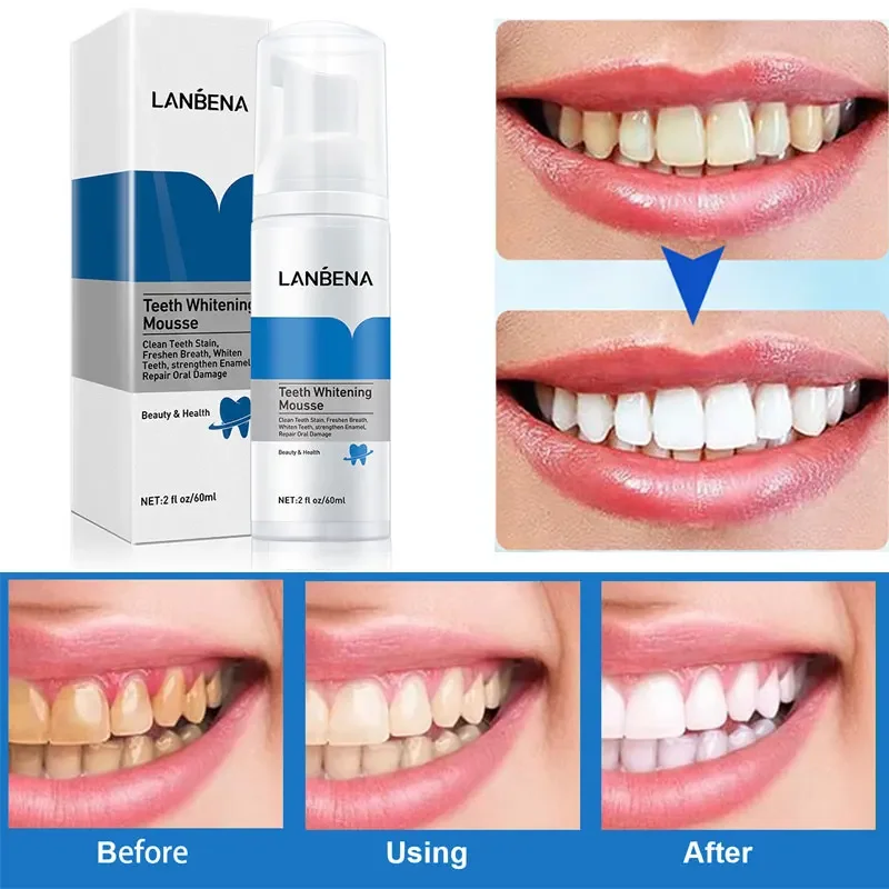 

LANBENA Teeth Whitening Mousse Remove Stains Tooth Cleaning White Teeth Oral Hygiene Toothpaste Bleaching Dental Tool Teeth Care