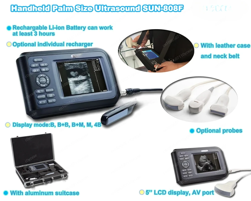 Hand Held Portable Veterinary Hospital Ultrasound Scanner Device