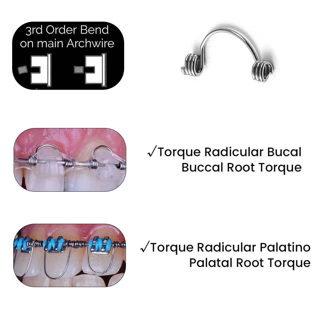 Ressort de couple orthodontique, 10 pièces/sac, ressort de couple antérieur, auxiliaire de couple, Warren, pour orthodontie