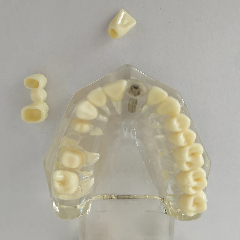 2023 przezroczysta choroba Model zębów Implant dentystyczny Model zębów dentysta Student stomatologii uczący się komunikacji w zakresie badań nad