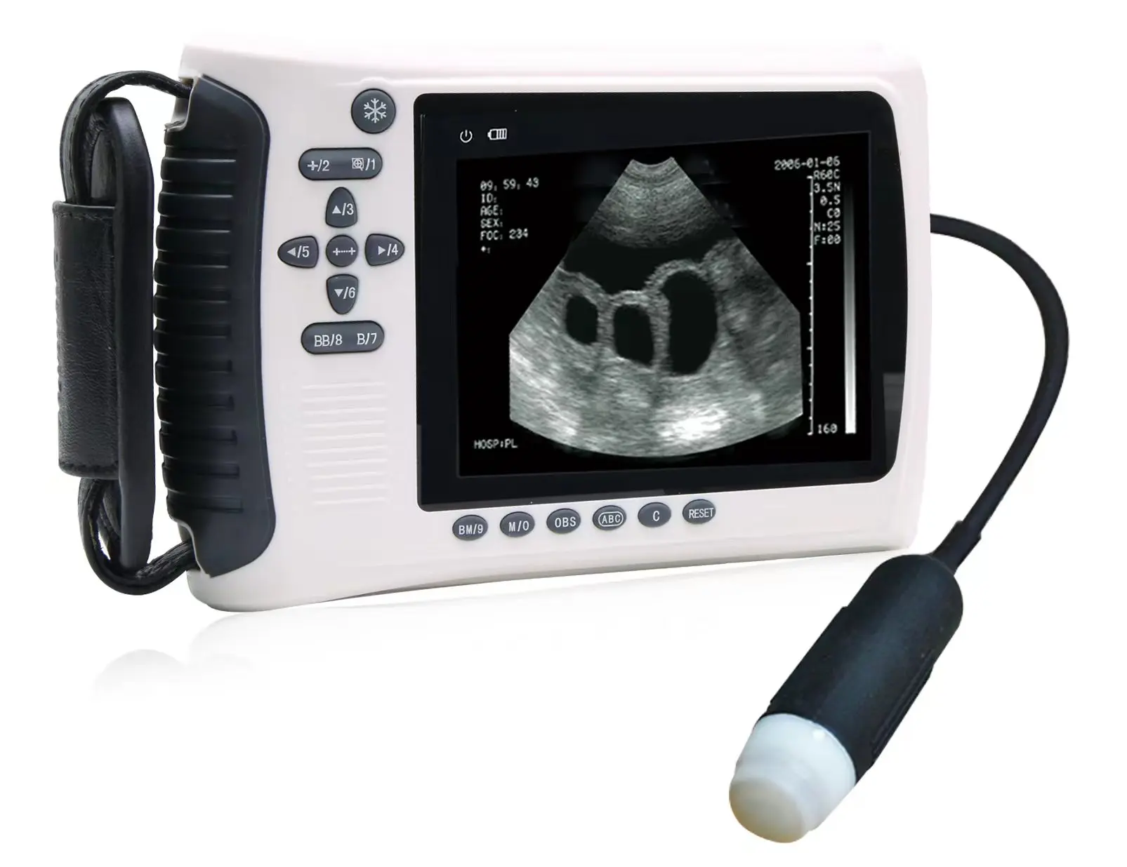 

Revised Sentence High-resolution Ultrasound Exams For Pregnant Sows, Sheep, And Goats