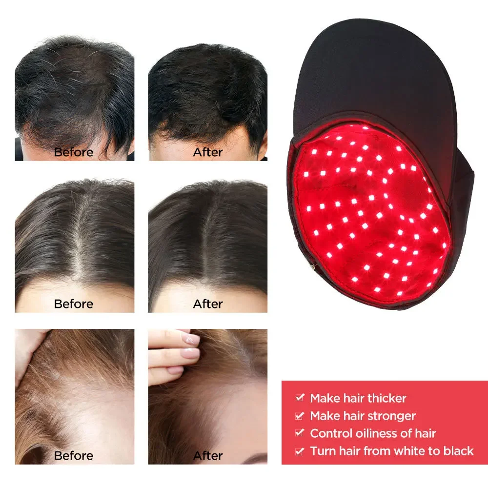 New 100Pcs Infrared LEDs 660nm&850nm Red Light Therapy Hair Growth Cap for Hair Regrowth Anti Hair Loss Relax Scalp Hair Care Ha