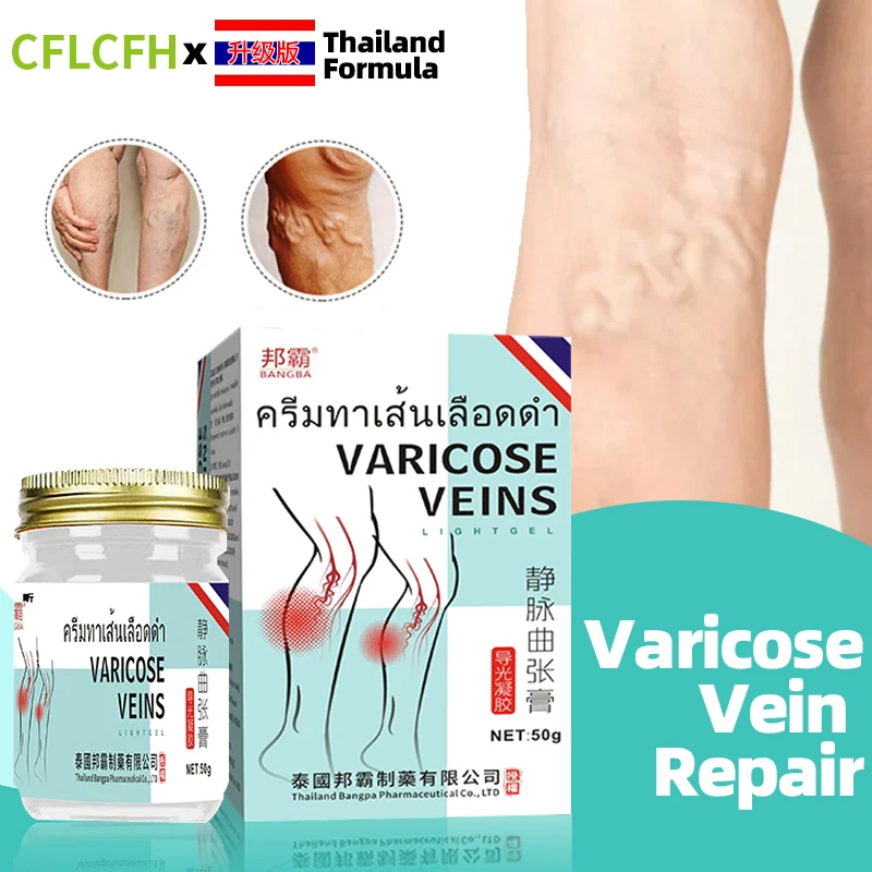 

Varicose Veins Cream Thailand Formula Vasculitis Phlebitis Spider Legs Treatment Angiitis Leg Dilated Relief Medicine Foot Care