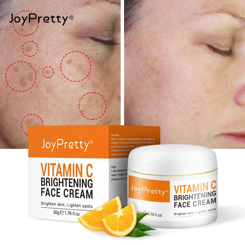 Pigment Spots Even Tone Health Cosmetics Anti-aging Korean Beauty Brightens Dull Skin Lightens Hyperpigmentation Acne Whitening