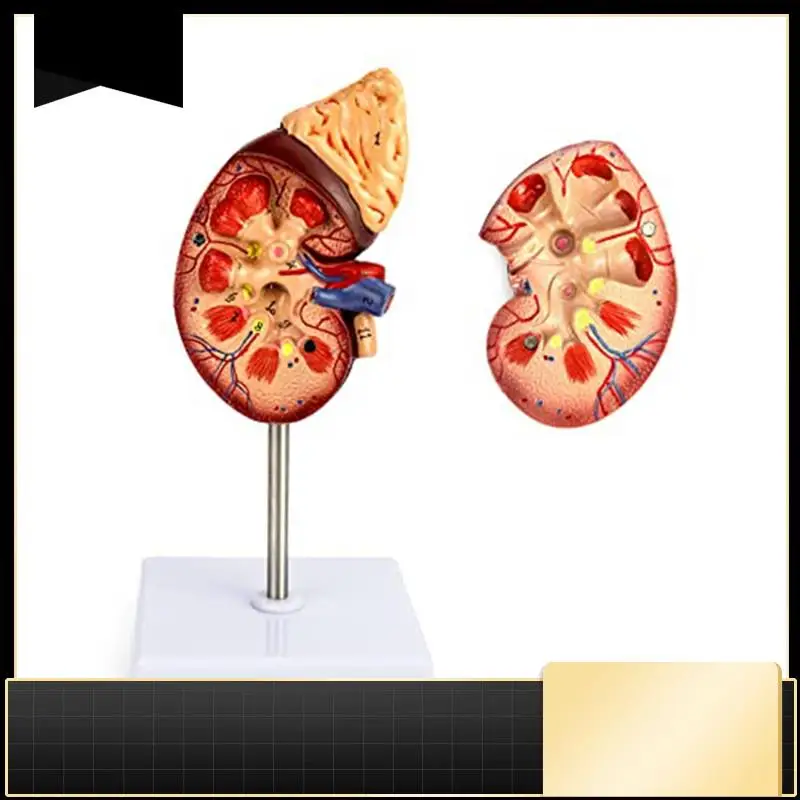 

Модель почек в натуральную величину, 2 части, показывающая внутреннюю структуру, реплика анатомии человека почки для врачей, образовательный инструмент